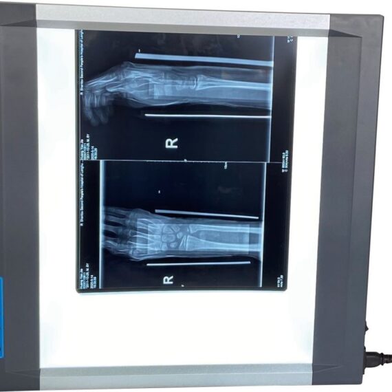 Négatoscope Ultra-Fin LED2