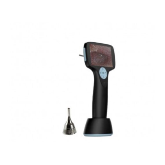 OTOSCOPE VIDEO DIGISKOP AUG1